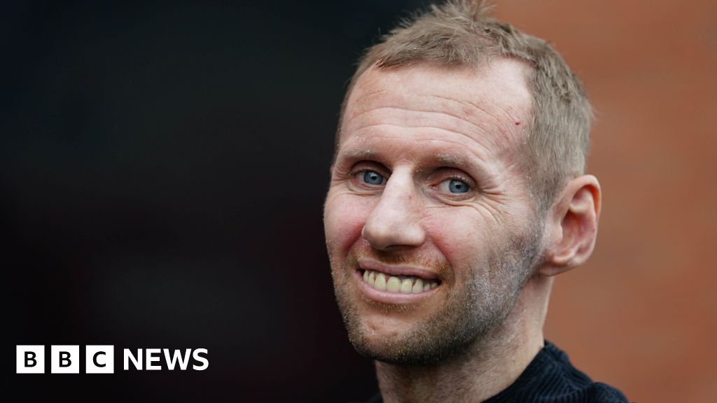 Rob Burrow Centre for Motor Neurone Disease to open its doors