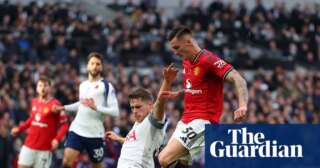 Injured Sesko to miss Slovenia games but United hopeful of swift return | Manchester United