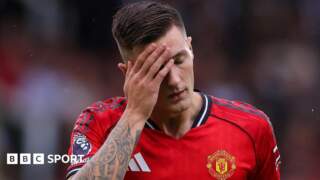 Benjamin Sesko: Man Utd and Slovenia striker out for about a month with knee injury