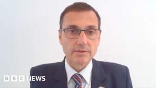 Hospital boss who raised bullying concerns ‘unlawfully excluded’, says union