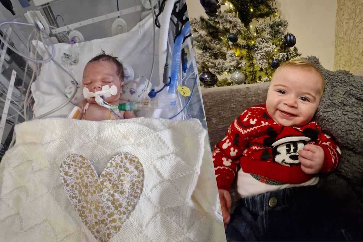 Open heart surgery saves one-week-old Sheffield baby's life – and now he's ready for his first Christmas