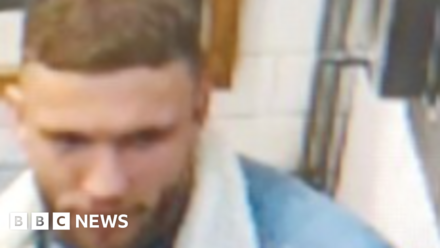 Man suffers serious head injuries in Richmond punch attack
