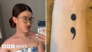 Northallerton woman’s tattoo moved to tongue in cancer treatment