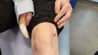 IT worker tells of ‘very, very scary’ police dog attack which left him injured and traumatised