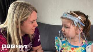 'I didn't know kids could get arthritis until my daughter was diagnosed'