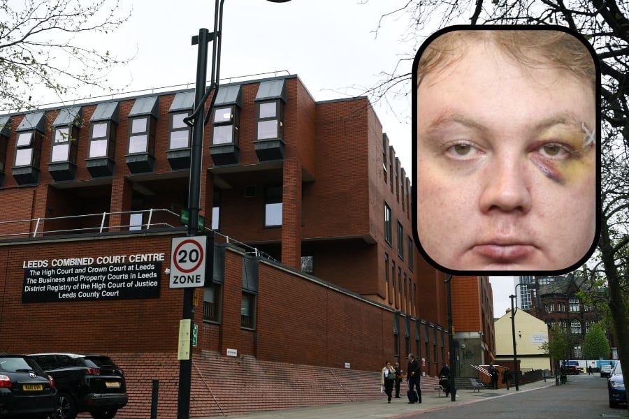 Known paedophile spared jail is then beaten up in  hotel days later
