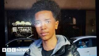 Concern for missing teen with facial injuries